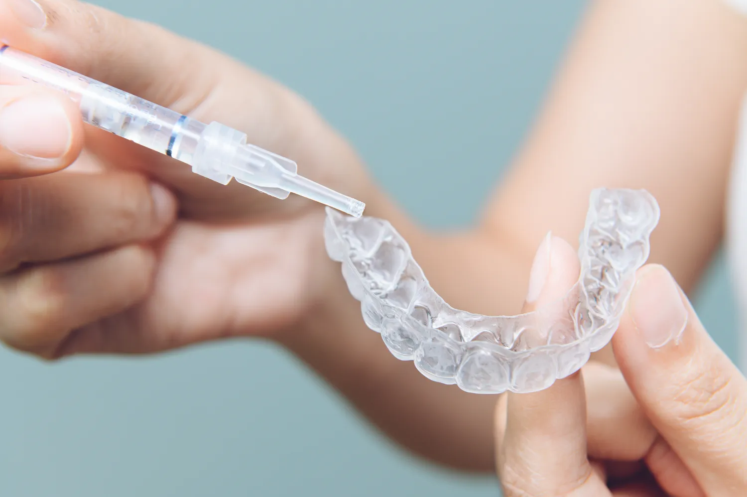 Aparat nakładkowy Invisalign Warszawa